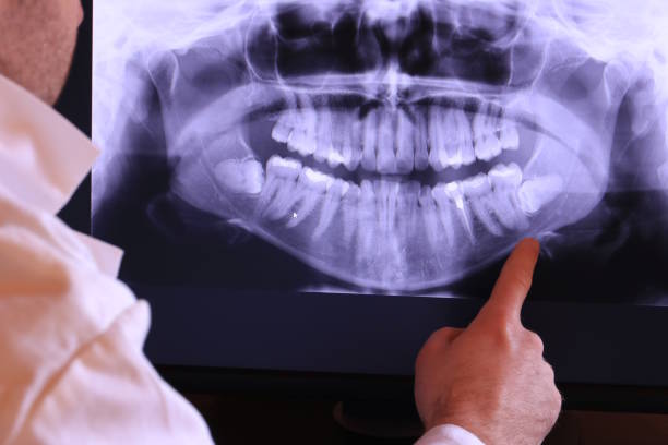 Best Orthodontic Emergency Dentist in Corning, IA